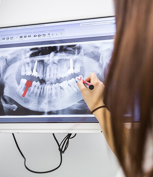 Dentist showing how dental implants work in Grand Prairie 