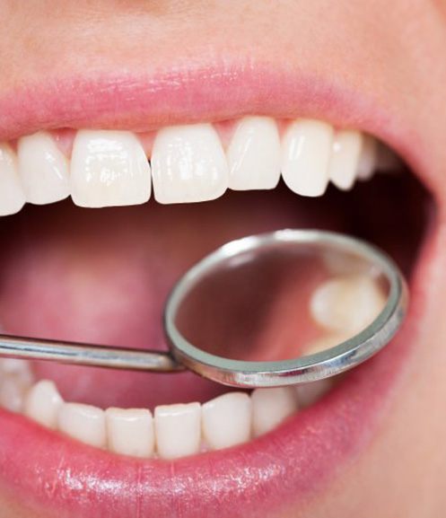 Teeth examined with dental mirror