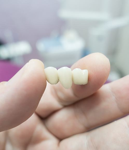 Hand holding a three-unit dental bridge
