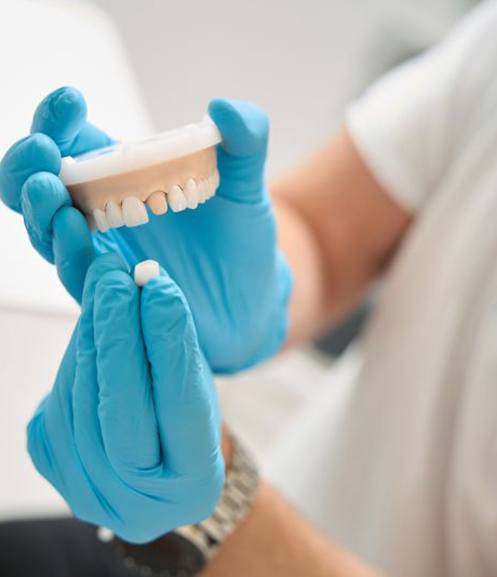 Dental team member demonstrating how a crown works