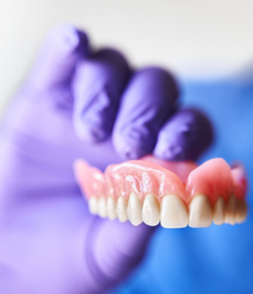 Gloved hand holding a full upper denture 
